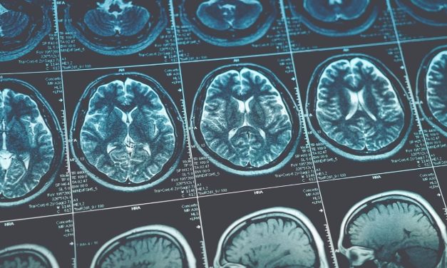 Szent Bálint nem csak a szerelmesek mentora – Az epilepszia világnapja